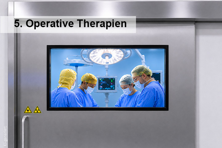 Sichtfenster eines Operationssaales mit Ärzten bei der Arbeit (gelbe OP-Mützen)